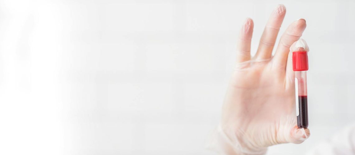 Adrenochrome : l'histoire d'un mythe glaçant